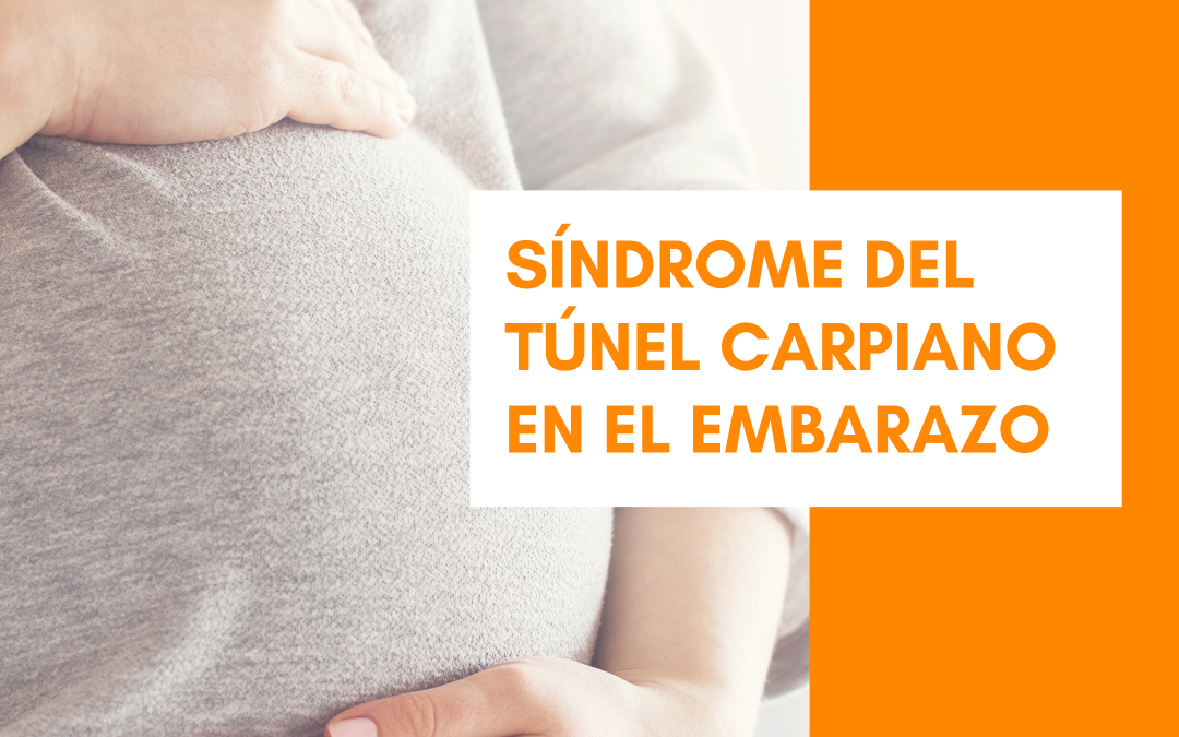 El Síndrome del Túnel Carpiano en el embarazo